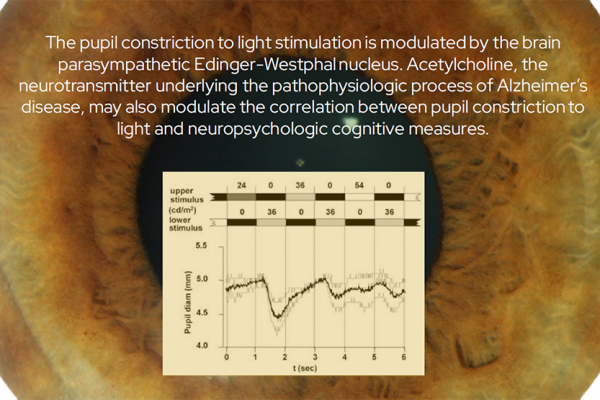 The pupil constriction to light stimulation is modulated by the brain parasympathetic Edinger-Westphal nucleus. Acetylcholine, the neurotransmitter underlying the pathophysiologic process of Alzheimer’s disease, may also modulate the correlation between pupil constriction to light and neuropsychologic cognitive measures.